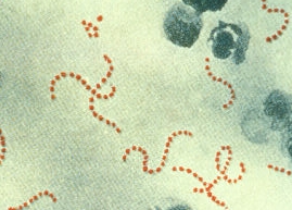 http://alsgals.files.wordpress.com/2010/04/streptococcus_pyogenes.jpg